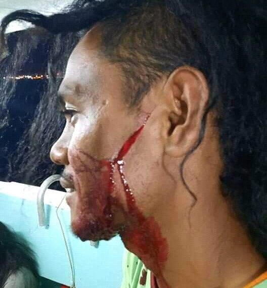 Wajah-ABK-Indonesia-Petrus-CT-berdarah-disebabkan-sabetan-ABK-Vietnam-pada-26-Februari-2021-di-Laut-Mau ritius-Afrika (KatongNTT)