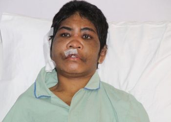 Kondisi Mariance Kabu saat dirawat di Rumah Sakit pada Desember 2014 (TEMPO/Masrur Dimyathi)