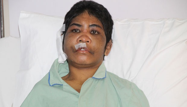 Kondisi Mariance Kabu saat dirawat di Rumah Sakit pada Desember 2014 (TEMPO/Masrur Dimyathi)