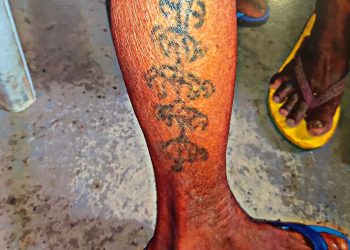 Tradisi Lunat atau tato pada masyarakat etnis Dawan di Pulau Timor yang punah antara lain disebabkan stigmatisasi. (Dok. Timor Indikator)