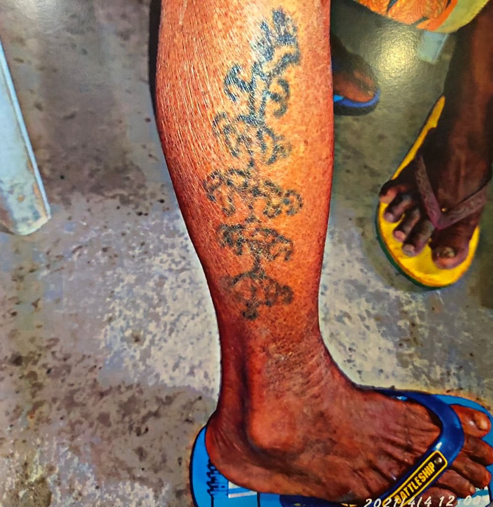 Tradisi Lunat atau tato pada masyarakat etnis Dawan di Pulau Timor yang punah antara lain disebabkan stigmatisasi. (Dok. Timor Indikator)