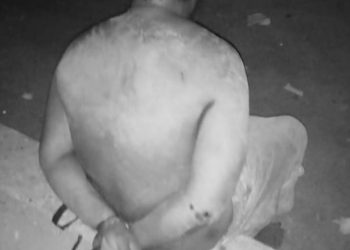 Yosef Lejap, korban dugaan penganiayaan oleh aparat kepolisian di Lembata (Dok. Andreas Lejap)