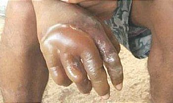 Suruh Siswa Celupkan Tangan di  Air Panas, Biarawan Katolik Dipolisikan