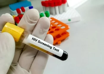 Lembata Resmi Tes HIV/AIDS Seluruh ASN