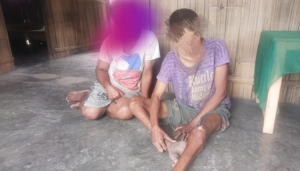 Banyak Penyandang Disabilitas di Manggarai Timur Tidak Bersekolah, Pemerintah Lakukan Apa?